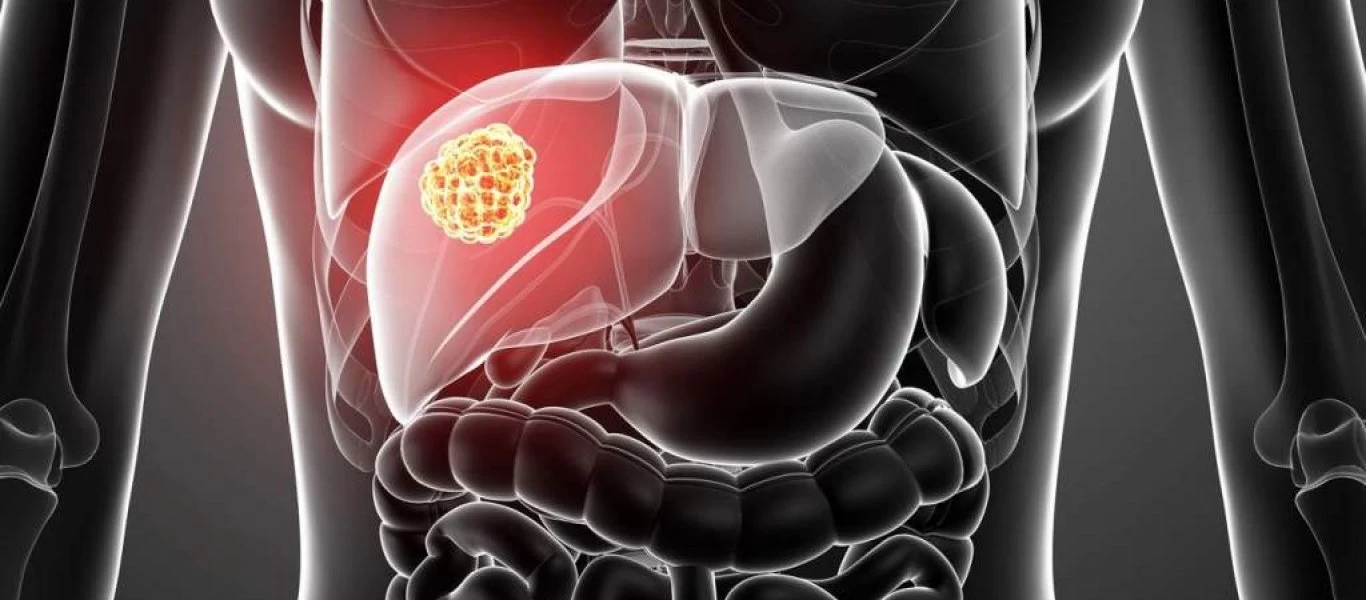 Συκώτι: Τι να κάνετε για να το προστατεύσετε από τις καταχρήσεις του καλοκαιριού